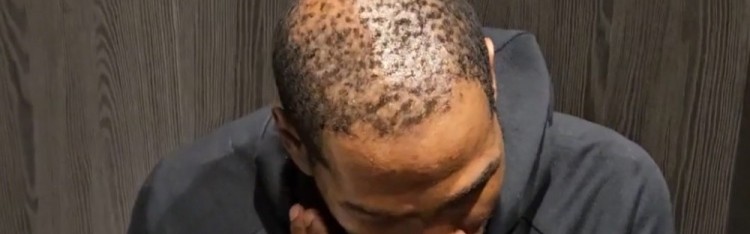 开云-37岁还单身有原因😳！杜兰特秃顶这么严重 这发量找对象难啊